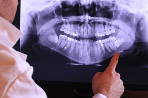 Best Knocked-Out Tooth Emergency  in Hoxie, AR