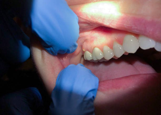 Best Cracked Tooth Emergency Dentist  in Hoxie, AR